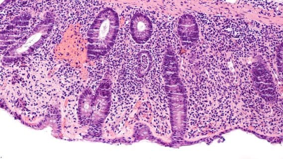 high coloured image of gut lining