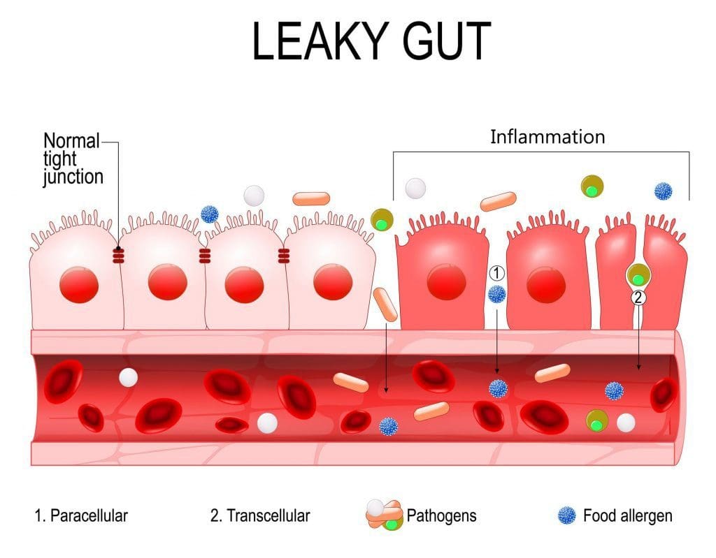 cross sectional diagram of leaky gut