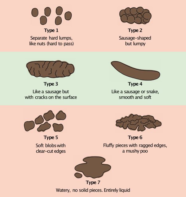 Read more about the article IBS poo chart (Bristol Stool Chart for IBS)