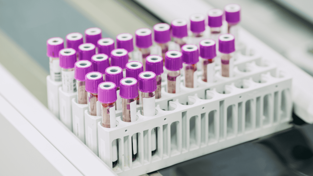 How to Test for Candida Overgrowth in Gut