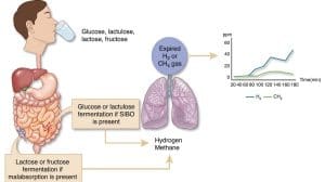 Read more about the article SIBO test: How a breath test measures hydrogen and methane