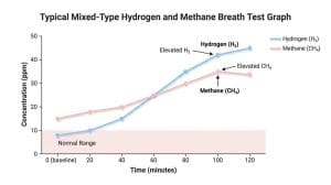 Read more about the article Methane SIBO and IMO: What You Need to Know